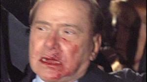 Silvio Berlusconi victime d’une agression ce soir