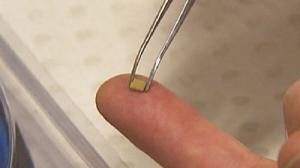 Vaccination : des “nanopatchs” à la place des seringues