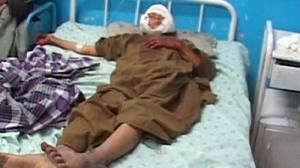 Dramatic increase in civilian casualties in Afghanistan