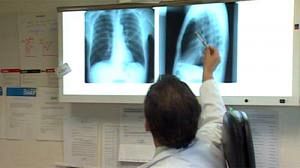‘Massive’ health savings from more CO2 cuts