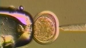 Embryo stem-cell treatment tested on humans in US