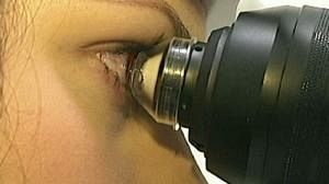 Seeing clearly: artificial corneas can restore sight