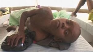 Haiti cholera cases underestimated: expert