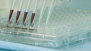 Exame de sangue que detecta cancro vai ser comercializado nos Estados Unidos