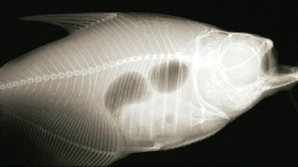 Low-cost portable X-ray machine hits market