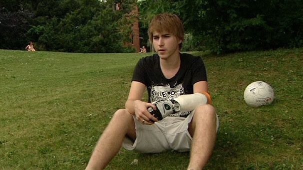A big hand for Austria’s bionic arm