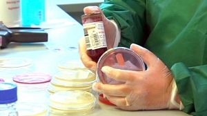 Bactéria mortífera transmite-se por contacto humano