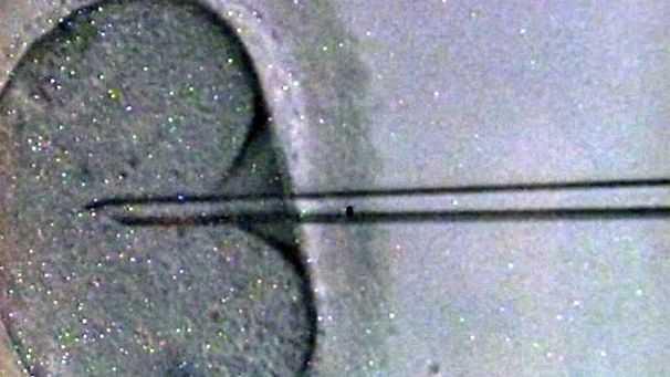 Overconfidence in IVF threatening fertility rates