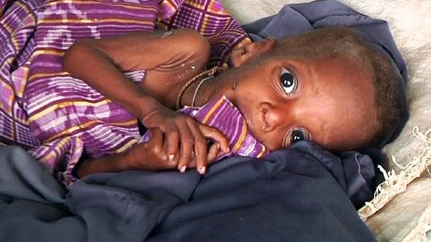 Drought causes thousands to flee Somalia