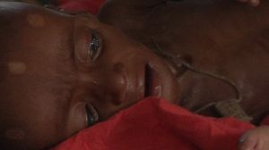 Famine dans la corne de l’Afrique : Habibo, un an, six kilos, presque aveugle