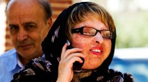 Iranian woman pardons man for acid attack