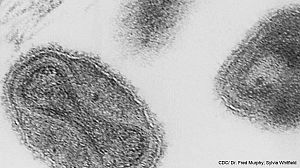 Back in the Day: Man kills disease