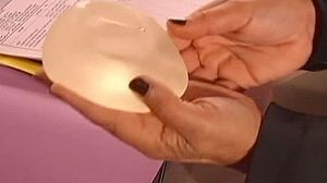 Mass breast implant recall in France