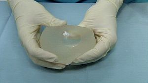 UK: Faulty breast implants don’t need removal