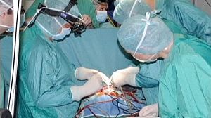 Rome doctors fit baby with ‘world’s smallest artificial heart’