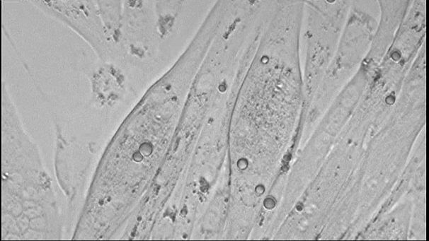 French scientists’ amazing discovery about dead bodies