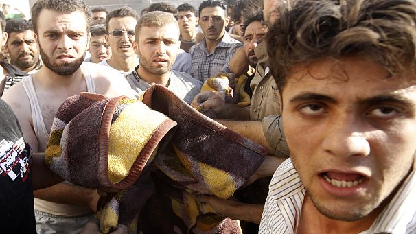 Le ferite della guerra in Siria