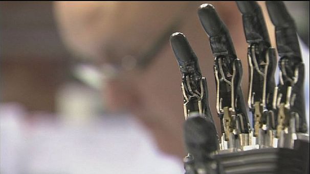 Natürlich greifen mit der bionischen Handprothese
