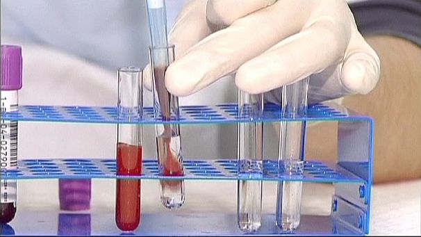Fahey “alarmed but not surprised” at doping scandal