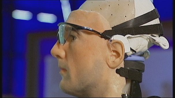 Meet Rex – the world’s first real bionic man