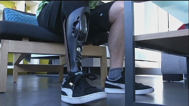 Printed prosthetics