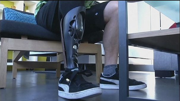 Printed prosthetics