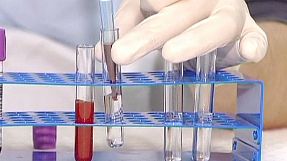 sport: Tennis steps up anti-doping measures