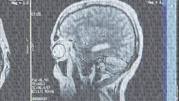 Coma software can accurately predict outcome