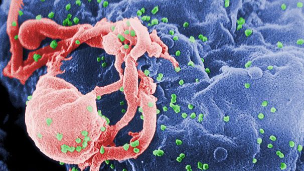 Early HIV treatment can ‘cure’ 10%