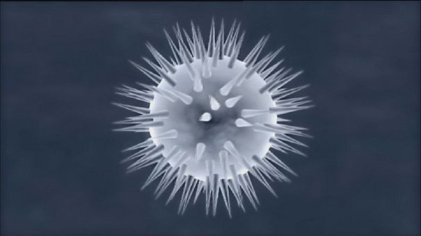 Scientists urge caution over AIDS ‘functional cure’