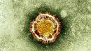 world Coronavirus: allarme in Francia