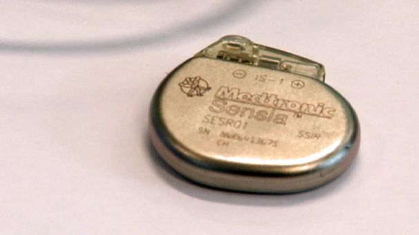 Shrinking the pacemaker