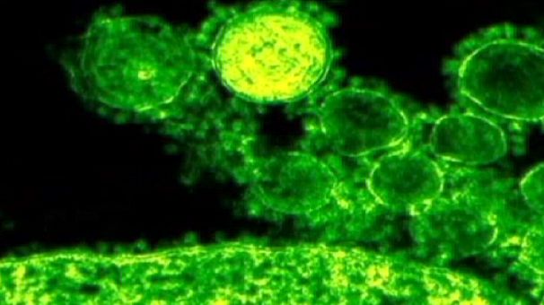 El nuevo coronavirus provoca la primera víctima en Francia
