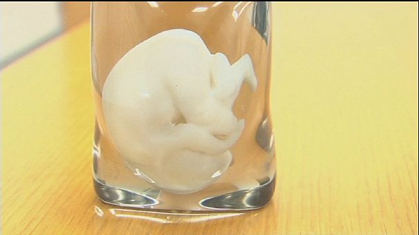 Une reproduction 3D du fœtus en souvenir de grossesse