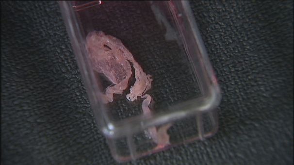 Stem cell therapy heals broken bones