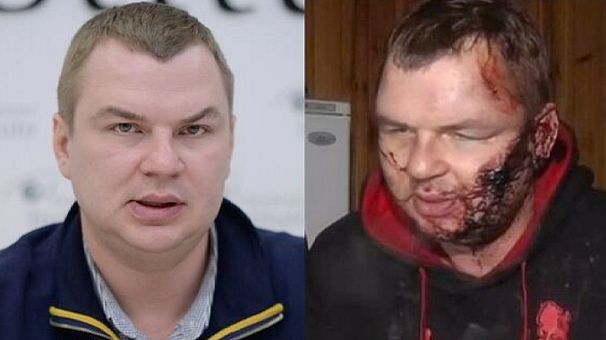 Ukraine government says ‘tortured’ activist Dmytro Bulatov is both victim and suspect