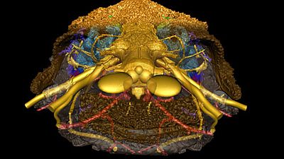 Ancient fish was pivotal in evolution of face researchers find Ancient fish was pivotal in evolution of face researchers find