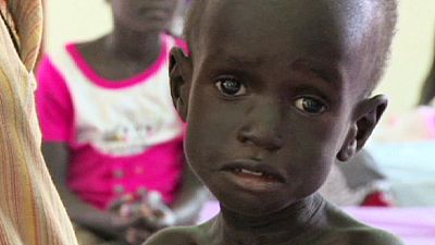 War, disease and hunger the unwanted guests as South Sudan ‘celebrates’ independence War, disease and hunger the unwanted guests as South Sudan ‘celebrates’ independence