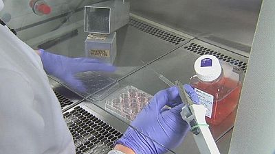Alzheimer’s disease test hopes Alzheimer’s disease test hopes