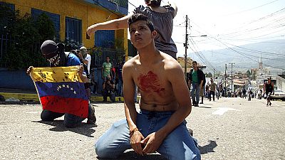 Police officer arrested after killing of 14-year-old boy during clashes Police officer arrested after killing of 14-year-old boy during clashes