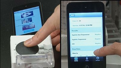 HIV test via your smartphone in 15 minutes HIV test via your smartphone in 15 minutes
