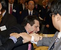 South Korea: Man arrested after knife attack on US ambassador South Korea: Man arrested after knife attack on US ambassador