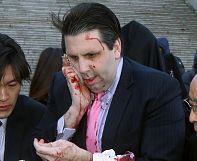 US vows not to cede to threats after knife attack on South Korea envoy US vows not to cede to threats after knife attack on South Korea envoy