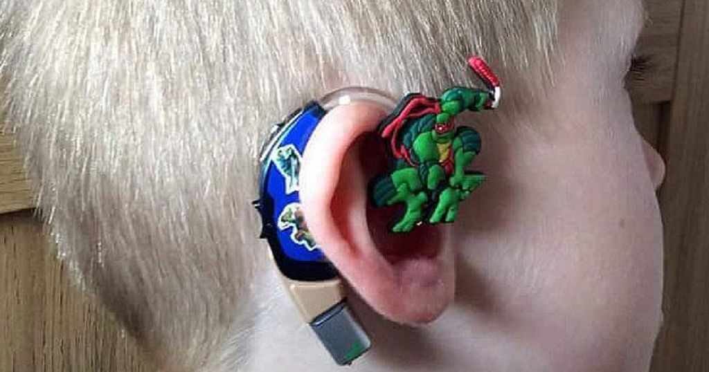 3D printed ear technology raising hopes of 2-year old girl - AfricaNews