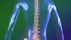 Effective therapy through neurostimulation