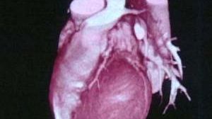 Vers la réparation des muscles du coeur