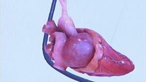 Doctors create virtual heart