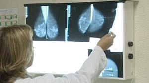 Ageing should double cancer screening