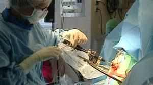 Deep-Brain-Stimulation gegen Parkinson-Krankheit
