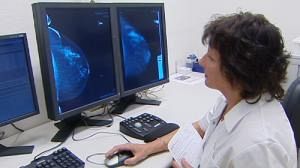 Rivoluzione digitale nel depistaggio del cancro al seno
